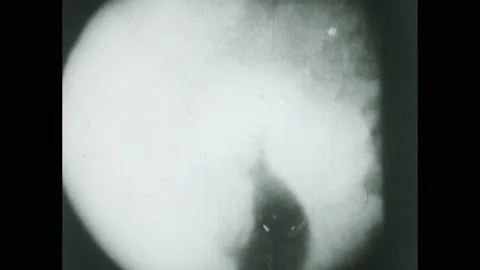 1950s: X-ray view of organs functioning. 動画素材 224169099