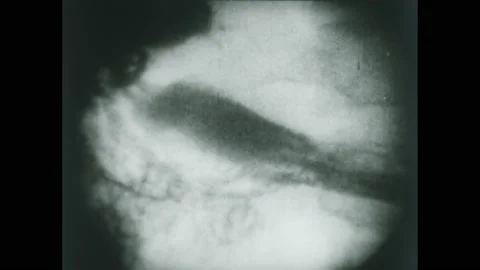 1950s: X-ray view of organs functioning. Food enters stomach. Stock Footage 224169160