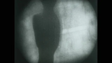 1950s: X-ray view of organs functioning. Food travels down esophagus. Video stock 224169178