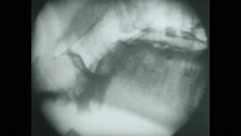 1950s: X-ray view of organs functioning. Person chews. 動画素材 224169226