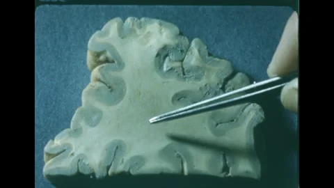 1960s: Parietal lobe brain slice sits on lab table. Tweezer points to the 스톡 동영상 247013345