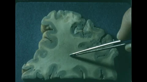 1960s: Parietal lobe brain slice sits on lab table. Tweezer points to the 스톡 동영상 247013361