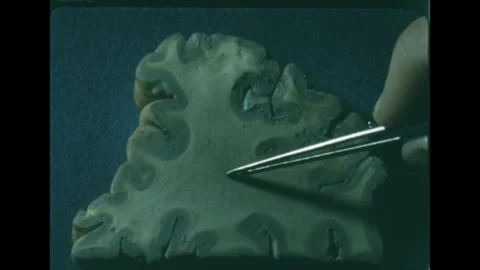 1960s: Parietal lobe brain slice sits on lab table. Tweezer points to the 스톡 동영상 247013371
