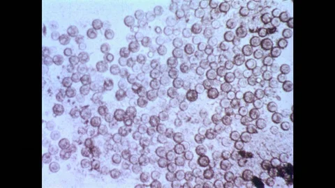 1960s: Single-celled organisms form cysts. Microscopic fungus sporangium. Rain Stock Footage 94465475