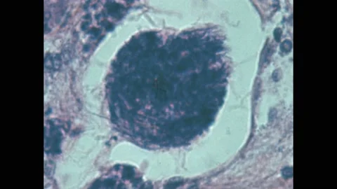 1960s: stained slice through cell. Parasites in water. Planarian parasite. Stock Footage 194187809