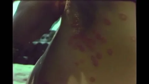 1960s - US Army doctors implement preventative medicine practices in Vietnam. Stock Footage 159336509