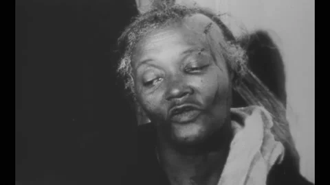 1964 - A doctor is interviewed while treating the head wounds of civil rights Stock Footage 248300811