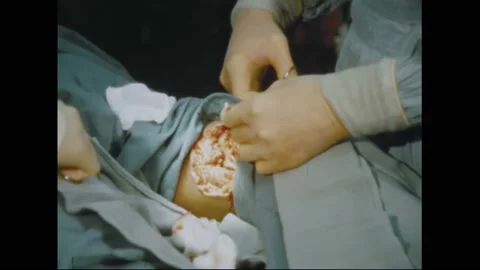 1969 - US Army doctors work on the bleeding knee of a Vietnamese POW. 스톡 동영상 241602031