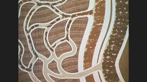1970s: Animation of sickle-cells that block blood flow through capillaries, red Stock Footage 87007722