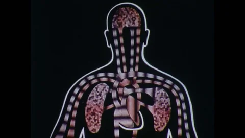 1970s: close up animation of blood flow to and from brain. close up animation of Stock Footage