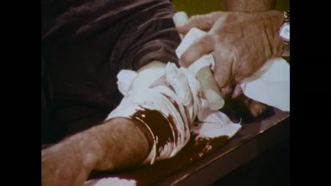 1970s: close up of hands applying pressure to arm wound. Man with injured arm Stock Footage 75162928