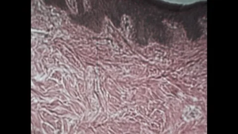 1970s: Microscopic view of muscle cells. Microscopic view of skin and hair 스톡 동영상 254366573