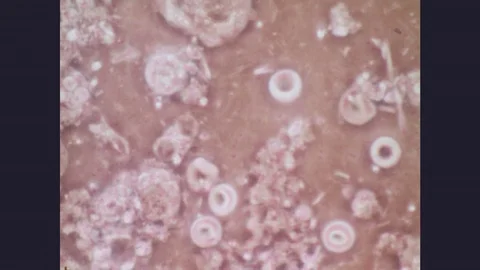 1970s: Microscopic view of organisms moving around; young woman looks at her Stock Footage 77253245