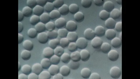 1980s: Dropper places water onto a microscope slide. Swelled red blood cells. Stock Footage 252859477