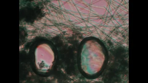 1980s: Microscopic cells break through b... | Stock Video | Pond5