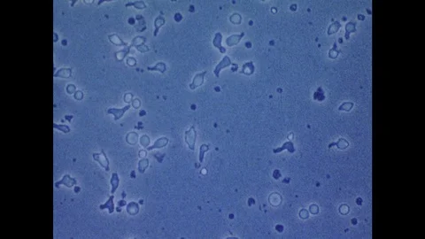 1980s:  UNITED STATES: time lapse of lymphocytes hunting virus cells. Cell death Stock Footage