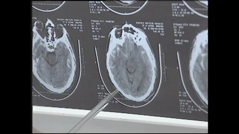 1990s: Man points to image of brain. Man speaks. Bicyclist falls off bike. Image Stock Footage 120488438
