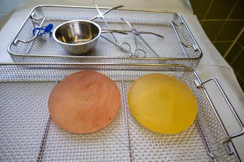 2 explanted silicone breast implants lie in an instrument basket Stock Photos