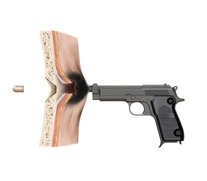 2 loose contact Stock Illustration