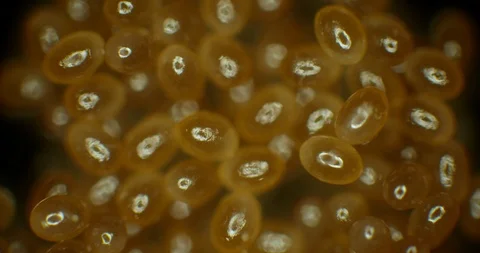 2 week old tick eggs Stock Footage 113128424