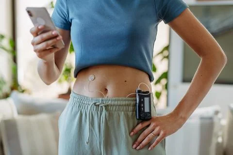 Close up of diabetic woman with insulin pump. Young woman with type 1 diabetes at home. xkwx young woman diabetic healthcare diabetes smart phone insulin pump continuous glucose monitor chronic illness social media sharing health technology medical device confident type 1 diabetes type 2 diabetes living with diabetes empowerment lifestyle beauty acceptance chronic disease awareness positivity treatment glucose blood sugar insulin therapy digital health self-love chronic condition patient advocate online community real-life strength body positivity National Diabetes Month november World Diabetes Day