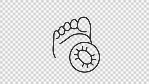 2D thin line black animation of infection on foot icon Stock Footage 267682617