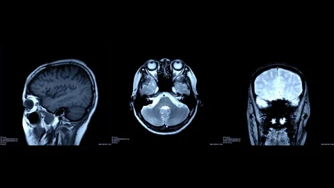 3 brain Stock Footage 112704846