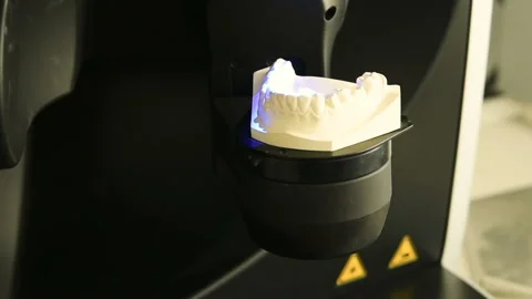 3-d scanning of the denture from gypsum Stock Footage 100536455
