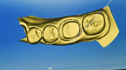 3-d scanning of denture from gypsum 動画素材 100536706