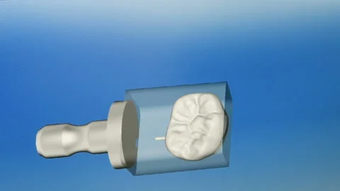 3-d scanning of denture from gypsum Stock-Footage 103753308