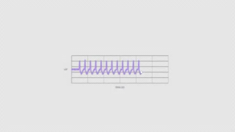 3 Hz Spike and Wave EEG Brain Wave Animation Clean No Text Video Overlay 4K Vídeos de archivo 339303722