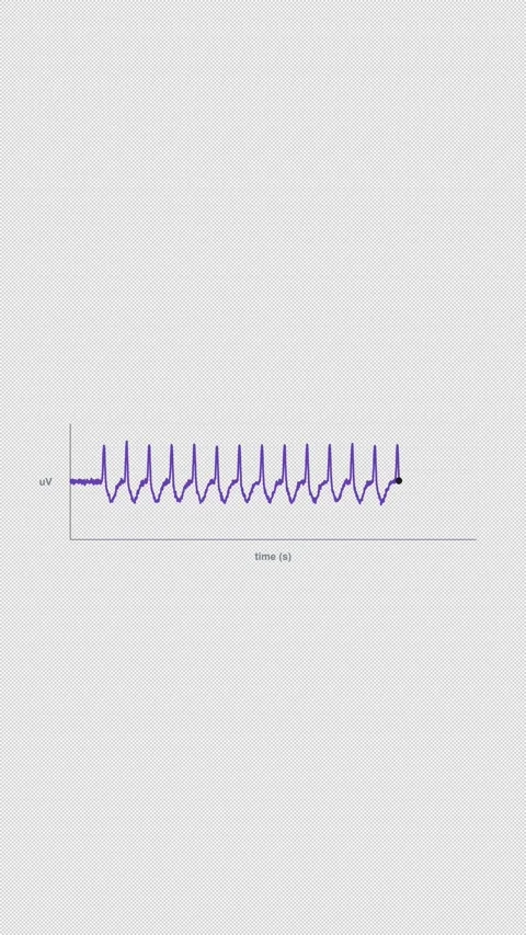 3 Hz Spike and Wave Clean No Text EEG Brain Wave Alpha 4K Vertical 9x16 Light Vídeo Stock 339493900