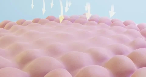 3d abstract animation of redness and aging of the skin from UV rays. Sunburn Stock Footage 246962787