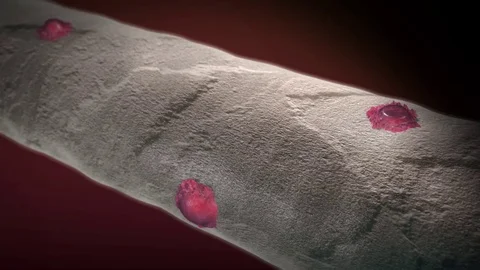 3D animated osteoclasts by Polymime http://www.polymime.com Stock Footage 75404857