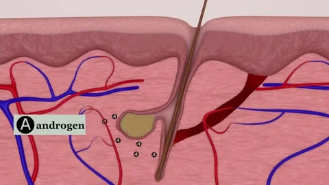 3D Animation of acne Video stock 158653600