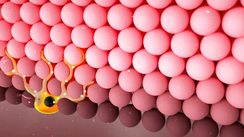 3d Animation Anatomy Skin Acne vulgaris or pimple. Skin layers Stock Footage 167451237