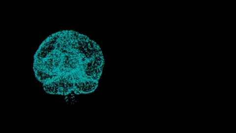 3D animation of brain neurons glitchhing, causing mental illness personality Stock Footage 121815408