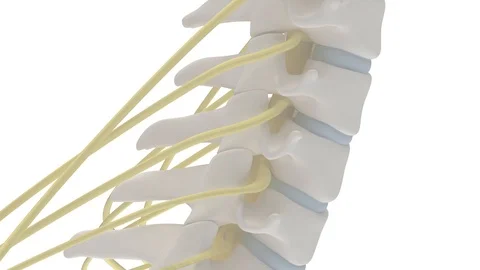 3d animation of cervical spine with prolapse of intervertebral disc Video stock 92634845
