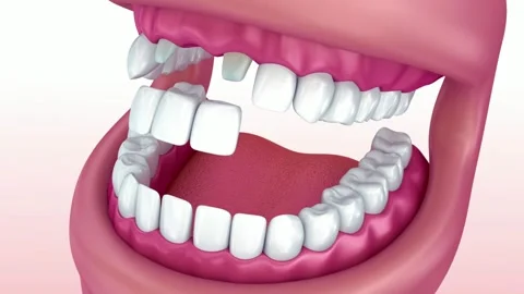 3D Animation of Complete Set of Healthy Human Teeth Stock Footage 327668592