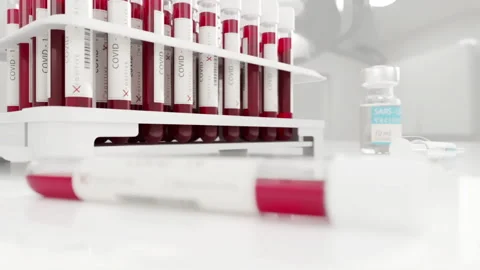 3D Animation. Coronavirus blood sample 3D medical animation. Positive test. 스톡 동영상 133137839