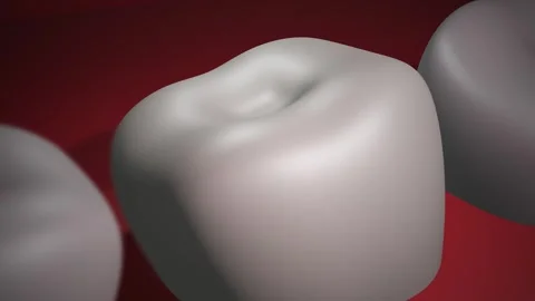 3D Animation of Crooked Molar Teeth - Orthadontist Concept Stock Footage 311053851