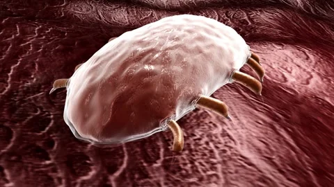 3D animation of dust mites on human skin and scalp 스톡 동영상 345199506