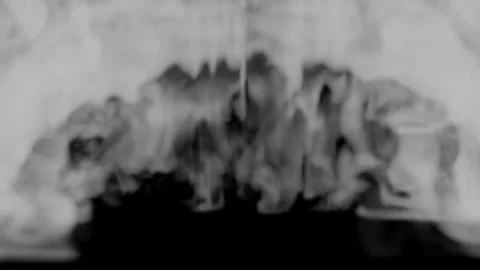 3D animation of gray smoke descending in clumps and filling Stock Footage 310320851