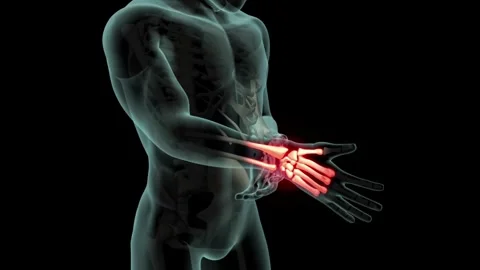 3d animation human body Man Suffering From Lower Back Pain healthcare and Video stock 336580326
