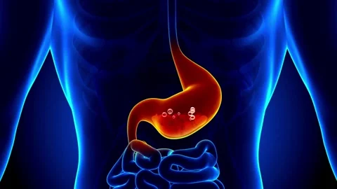 3d animation human body Man Suffering From disease in stomach acid Pain Video stock 336580346