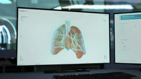 3d Animation Of Lungs On Computer Screen In Biological Study To Set Diagnosis Stock Footage 159100003