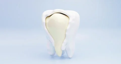 3D animation process of creating a tooth enamel shell Stock Footage 307941211
