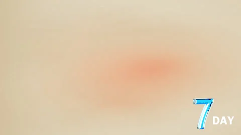 3d animation serum showcombination vitamins, reduce wrinkles , glowing skin, Stock Footage 158320236