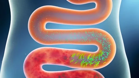 3D animation showing intestinal probiotics removing toxins 스톡 동영상 344102399