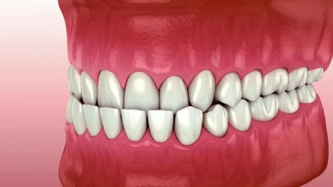 3D Animation Showing Tooth Roots and Jawbone Structure Stock Footage 327668534